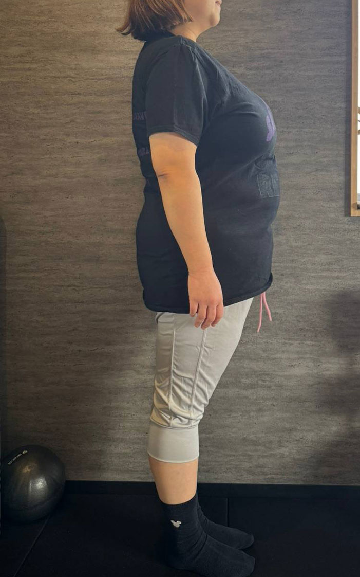 S.S様(40代) 横向き Before
